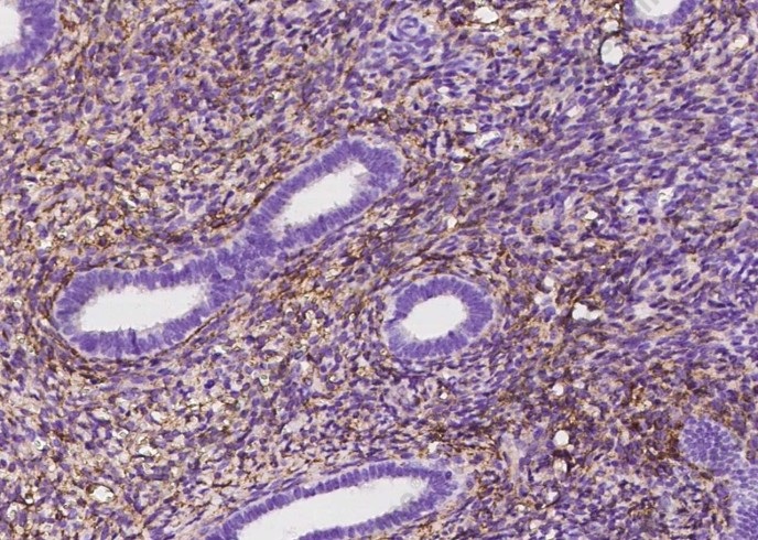 CD10 Monoclonal Antibody - 4