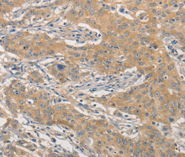 NFE2L1 Polyclonal Antibody - 3