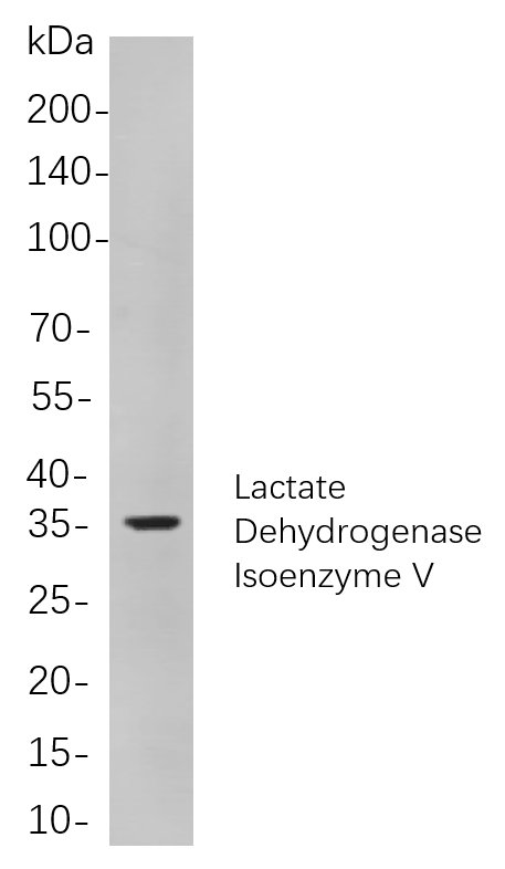 Recombinant Lactate Dehydrogenase Isoenzyme V Monoclonal Antibody-searchlist-1