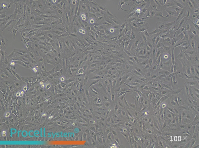 U-2 OS [U2OS] Cell Complete Medium - 1