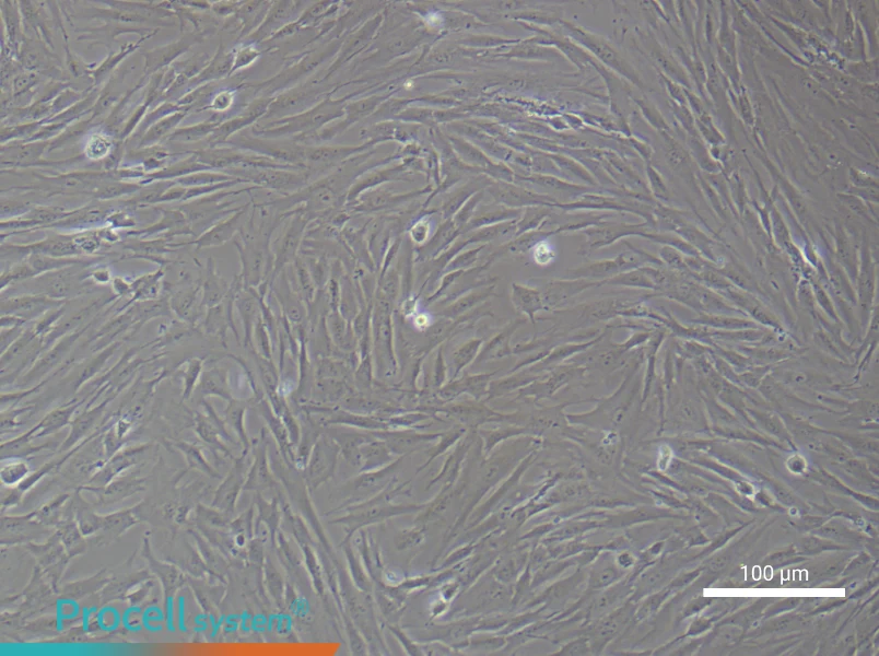 Human Gingival Fibroblast Complete Medium - 2