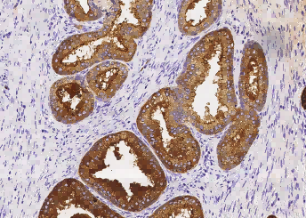 Recombinant TSPAN1 Monoclonal Antibody - small - 3