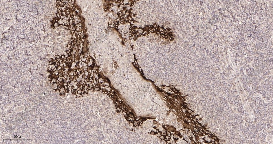 Recombinant Cytokeratin 5 Monoclonal Antibody - 2