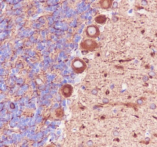 Recombinant beta III Tubulin Monoclonal Antibody - small - 5