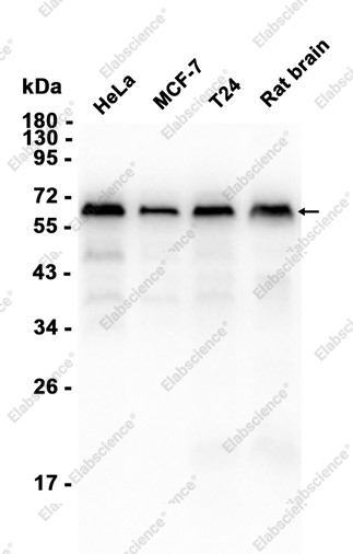 Recombinant Smad2/3 Monoclonal Antibody - 2