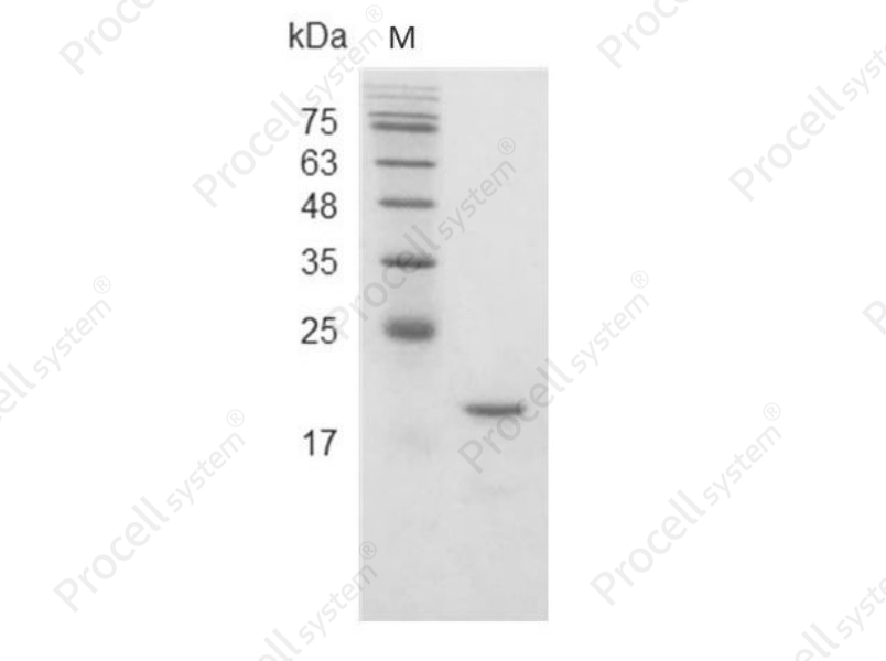 IFN&beta; 1a/IFNB1, Mouse, Recombinant