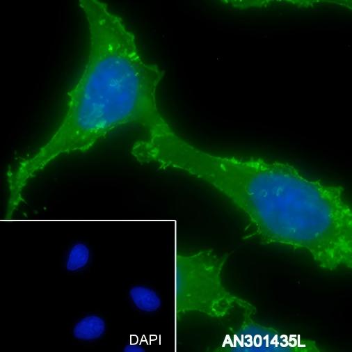 Recombinant alpha smooth muscle Actin Monoclonal Antibody - small - 6
