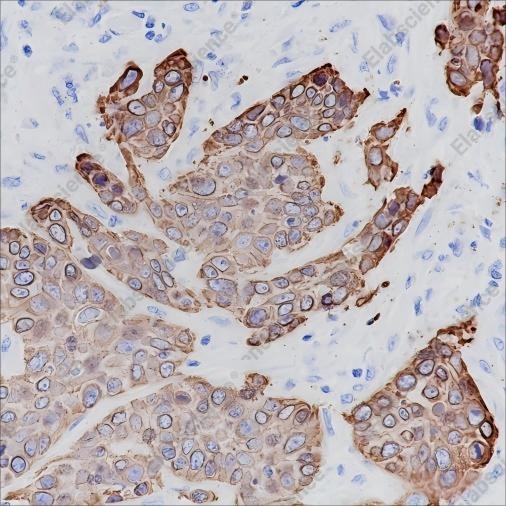 Recombinant Keratin 17 Monoclonal Antibody - 2