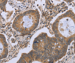 FKBP8 Polyclonal Antibody - 2