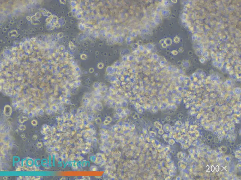 JVM-2 Cell Complete Medium - small - 4