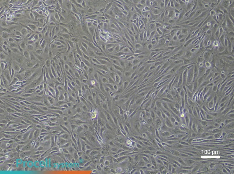 Human Pulmonary Great Vein Endothelial Cell Complete Medium - 2