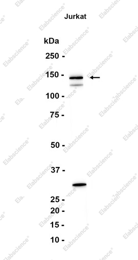 Recombinant Lipin 1 Monoclonal Antibody - 1