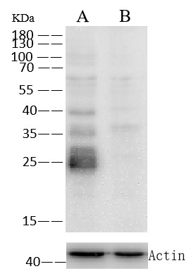 Recombinant Cathepsin L1/CTSL1 Monoclonal Antibody - small - 2