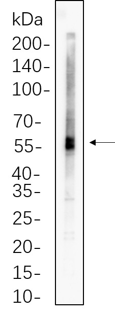 Recombinant ATGL Monoclonal Antibody-searchlist-1