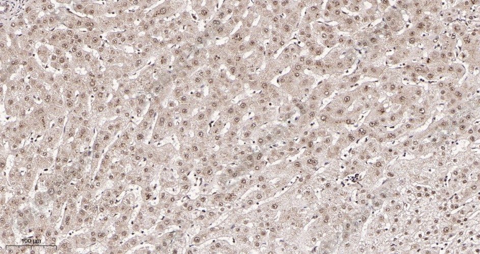 Recombinant Glucocorticoid Receptor Monoclonal Antibody - 2