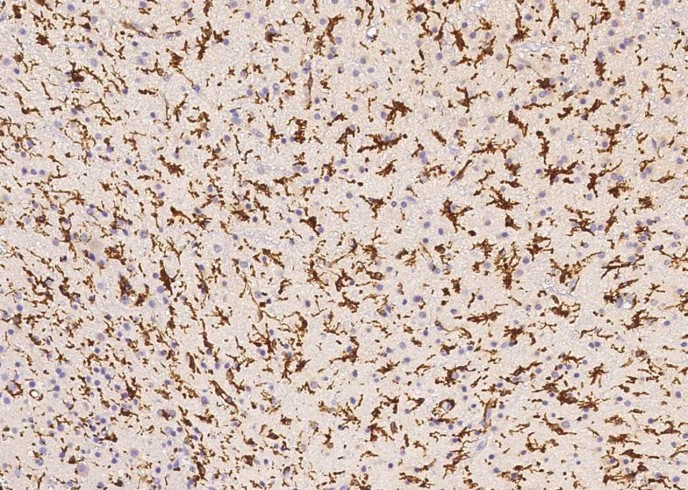 Recombinant IBA1/AIF1 Monoclonal Antibody - small - 2