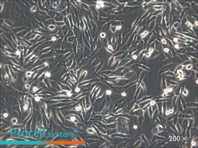 NUGC-3 Cell Complete Medium - 6