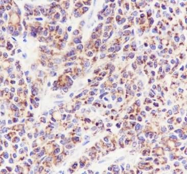 Recombinant PTP1B Monoclonal Antibody - 3