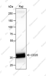Recombinant CD20 Monoclonal Antibody - 1