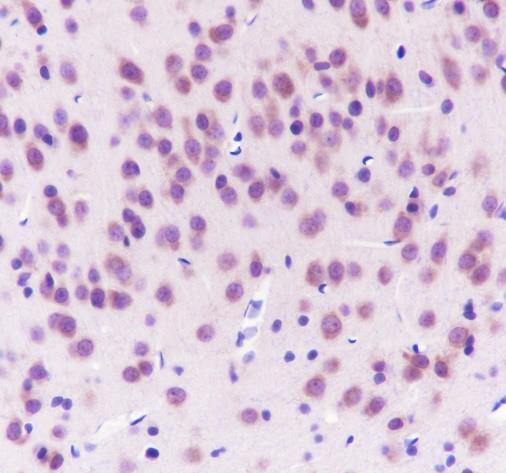 Recombinant KIR3DL1 Monoclonal Antibody - small - 4