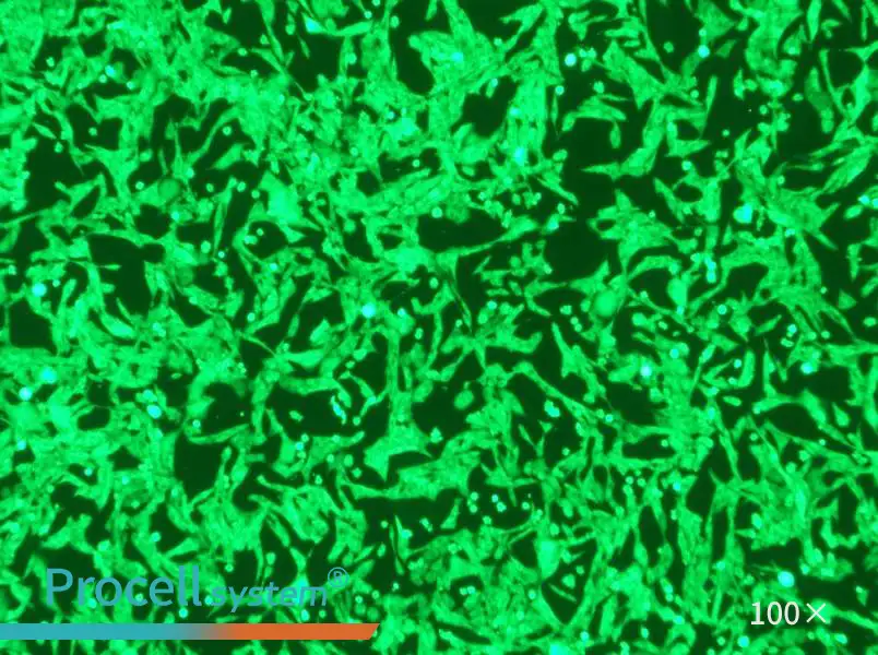 NCI-H446-GFP Cell Complete Medium - 1