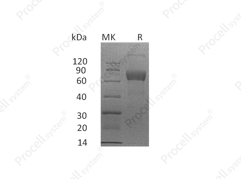 IL-4R&alpha;/CD124 (C-mFc), Human, Recombinant