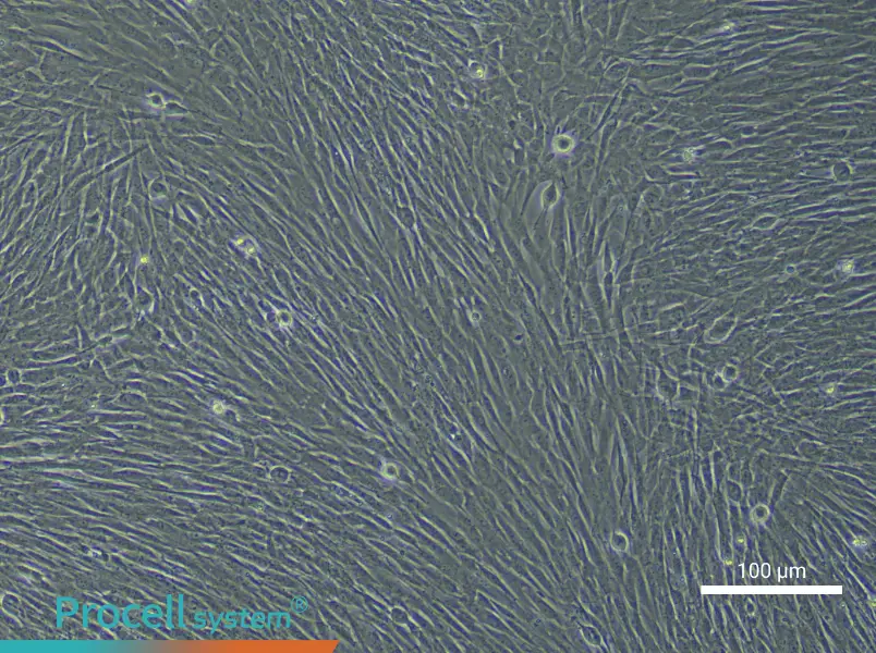 Human Dermal Fibroblast (Primary cell immortalization) Complete Medium - 1