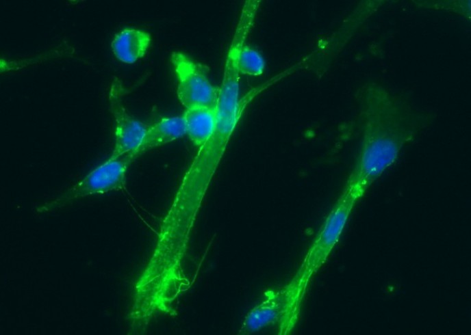 CD166/ALCAM Monoclonal Antibody - small - 2