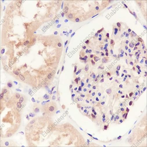 Recombinant SBDS Monoclonal Antibody - 3