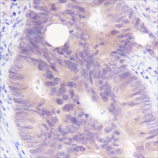 Recombinant SETBP1 Monoclonal Antibody-searchlist-1