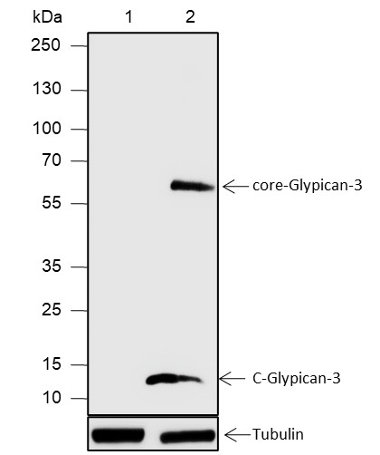 Recombinant Glypican-3 Monoclonal Antibody - small - 1
