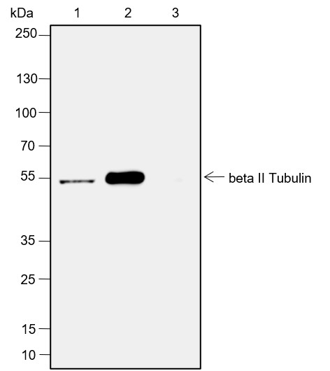 Recombinant beta II Tubulin Monoclonal Antibody - small - 5