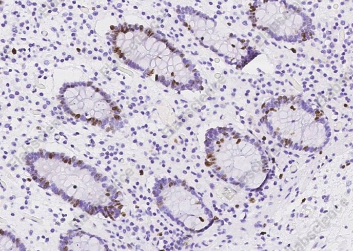 Ki67/MKI67 Monoclonal Antibody - 1