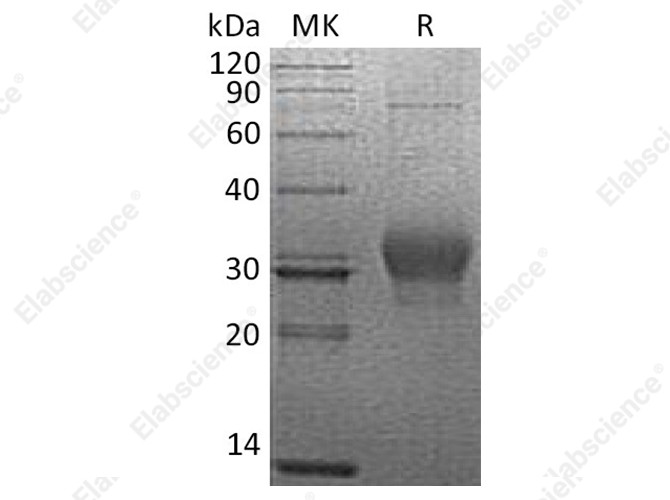 Recombinant Human CSN3/CASK Protein (His Tag) - 1