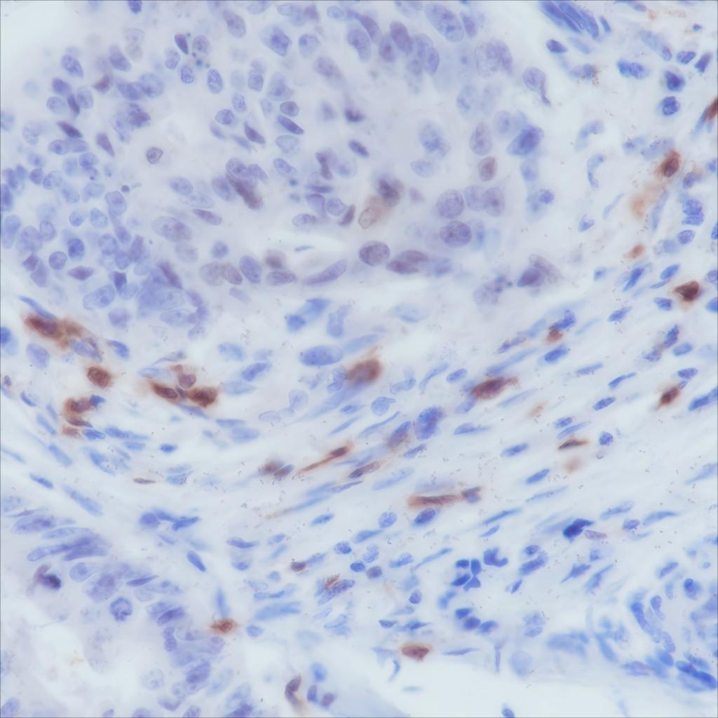 Recombinant CD103 Monoclonal Antibody-searchlist-1
