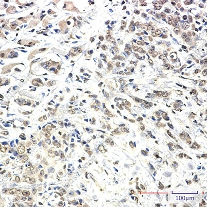 Recombinant KIF5B Monoclonal Antibody - 4