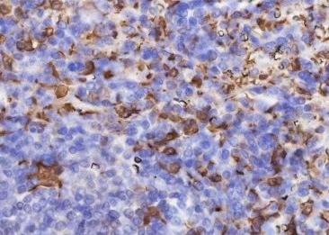 Recombinant Heme Oxygenase 1 Monoclonal Antibody-searchlist-3