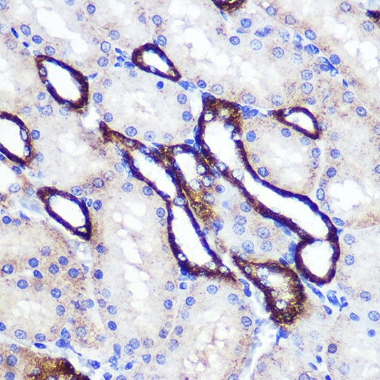 SIRT2 Polyclonal Antibody - small - 5
