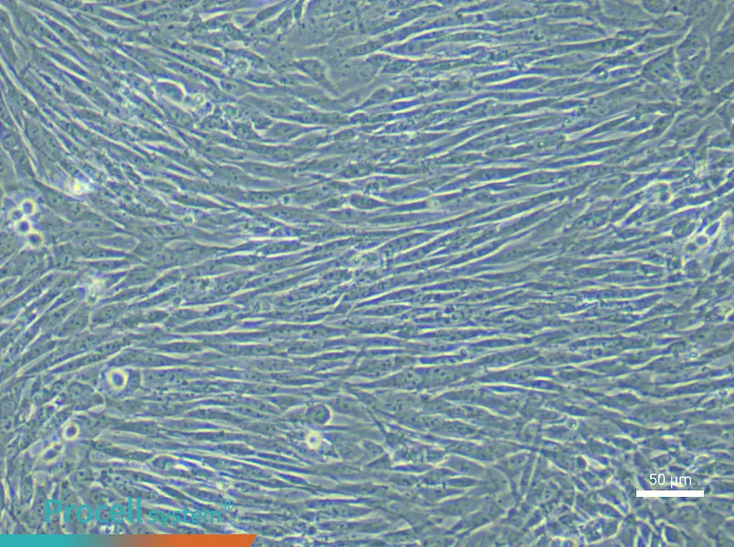 Mouse Pancreatic Stellate (Primary cell immortalization) Cell Complete MediumMouse Pancreatic Stellate (Primary cell immortalization) Cell Complete Medium - 5