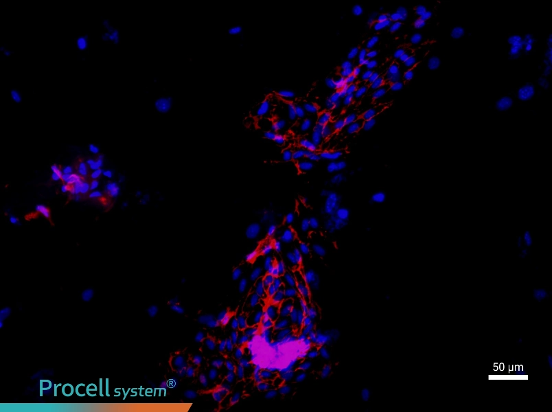 Mouse Aortic Endothelial Cells - 1