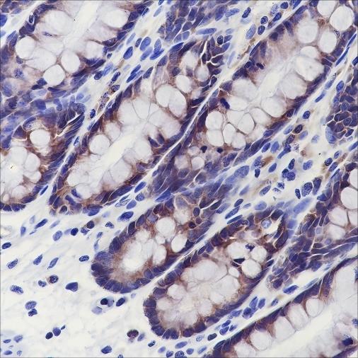 Recombinant eIF3B Monoclonal Antibody - 2