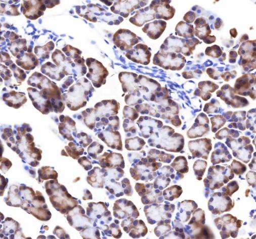Recombinant RPL26L1 Monoclonal Antibody - small - 5