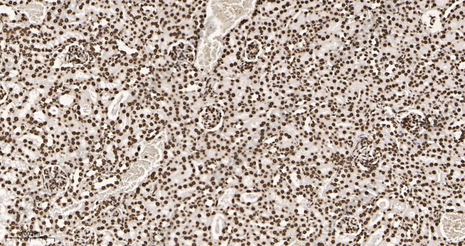 Recombinant Histone H4 Monoclonal Antibody - 3