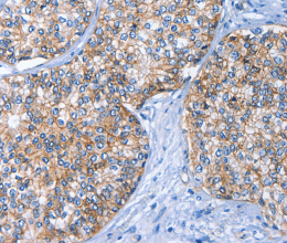 CD239 Polyclonal Antibody - 2
