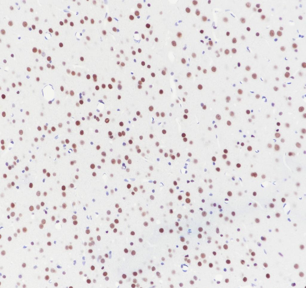 Recombinant PBX1 Monoclonal Antibody - 3