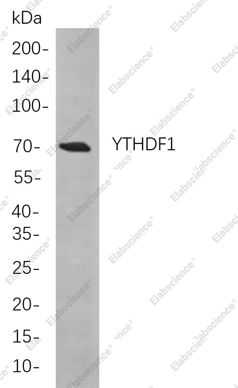 Recombinant YTHDF1 Monoclonal Antibody - 1