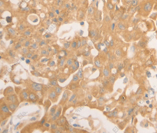 NAP1L1 Polyclonal Antibody - 3