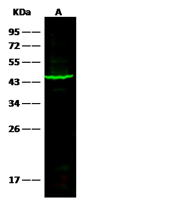 SerpinB1/ELANH2 Monoclonal Antibody-searchlist-1