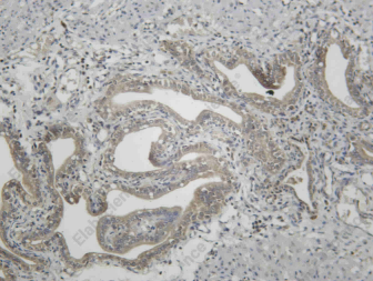 Recombinant Raf-1 (Phospho Ser259) Monoclonal Antibody - 1