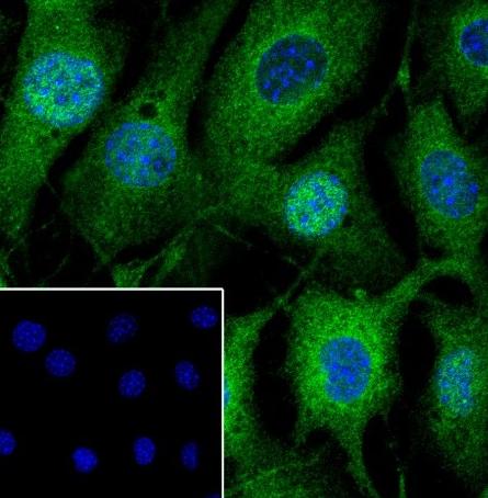 Recombinant NF-kB2 p100/p52 Monoclonal Antibody - small - 5